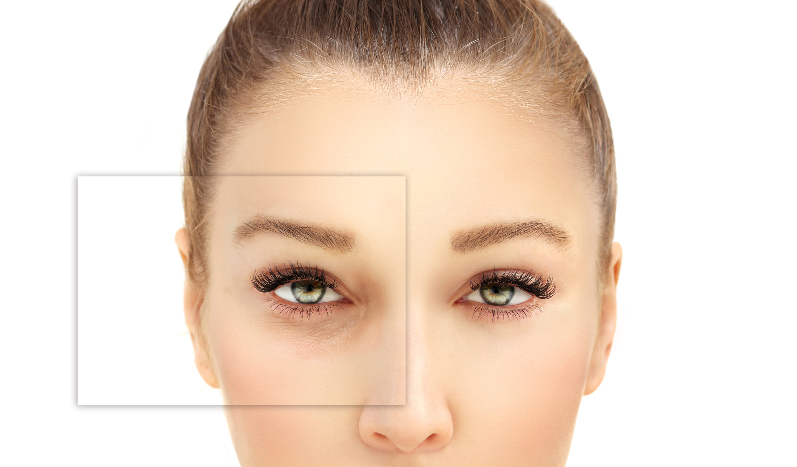 Profiloplasty: What is Profile Aesthetics?